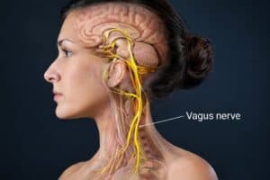 Eine Ärztin untersucht eine Person mit einem implantierten Vagusnervstimulator.