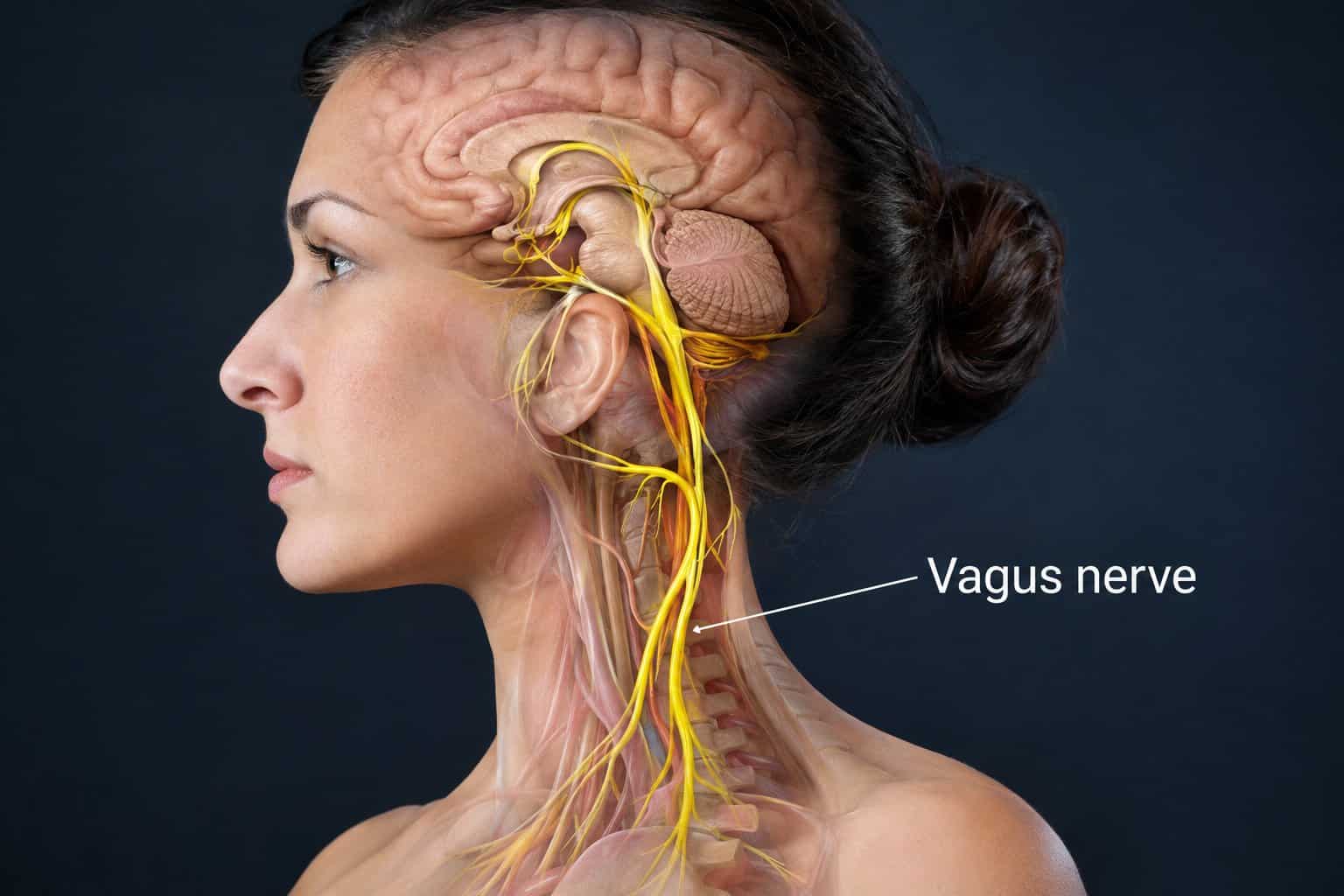 Eine Ärztin untersucht eine Person mit einem implantierten Vagusnervstimulator.